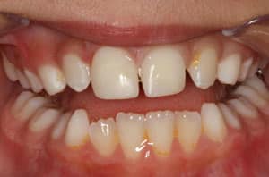 pediatric dentistry after